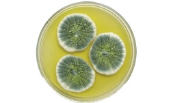 Fungal Culture